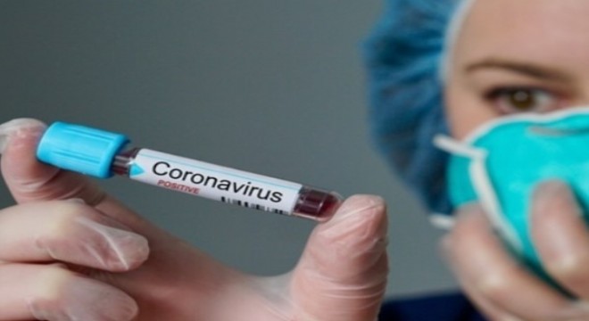 COVİD-19 sonrası komplikasyonlar risk oluşturuyor