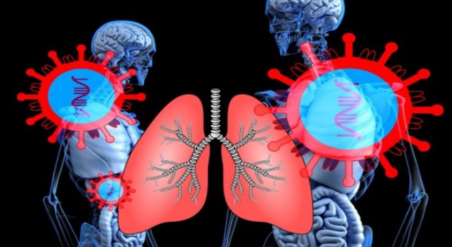 Türkiye Akciğer Kanseri görülme sıklığında ilk 10 ülke arasında
